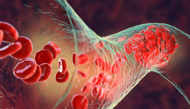 Hipertensión-arterial-pulmonar.png